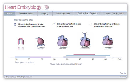screen capture of the cardiac embryology application