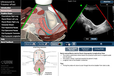 Normal Exam: Suprapubic Transverse View - cross-section