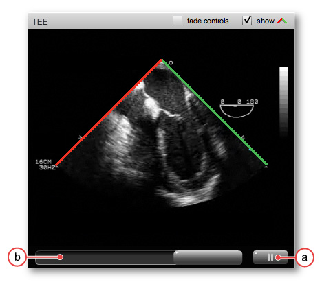 figure 1:video controls