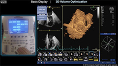 3D Volume Optimization