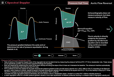 Aortic Valve Assessment