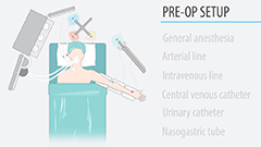 Pre-op setup