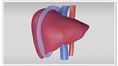 Living donor right hepatectomy