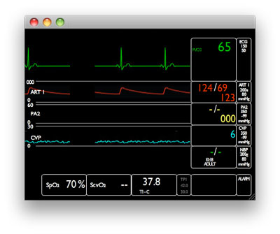 Critical Care Monitor