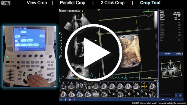 GE E9 - Cropping 3D datasets