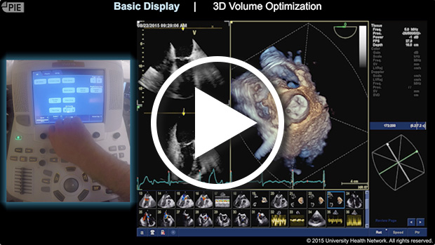 GE E9 - Cropping 3D datasets