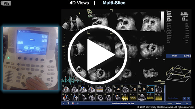 GE E9 - Alternate Display of 3D Datasets