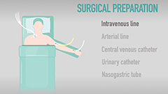 Pre-op setup